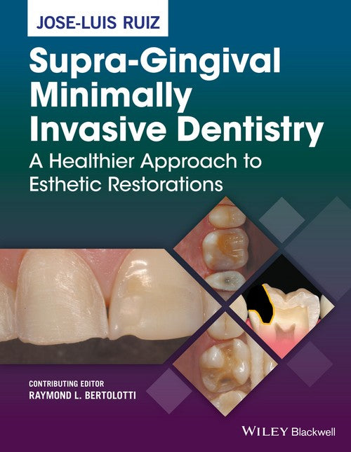 Supra-Gingival Minimally Invasive Dentistry by Jose-Luis Ruiz ISBN 9781118976418