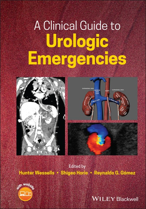 A Clinical Guide to Urologic Emergencies by Hunter Wessells ISBN 9781119021476