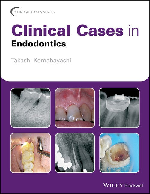 Clinical Cases in Endodontics by Takashi Komabayashi ISBN 9781119147046