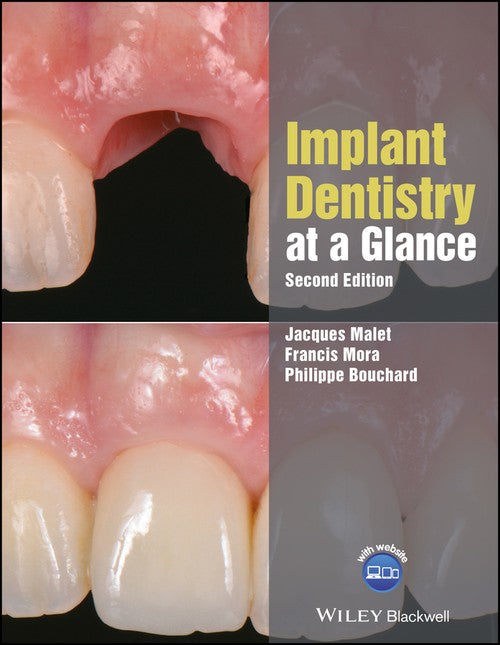 Implant Dentistry at a Glance by Francis Mora ISBN 9781119292609