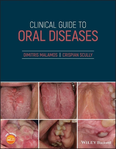 Clinical Guide to Oral Diseases by Dimitris Malamos ISBN 9781119328117