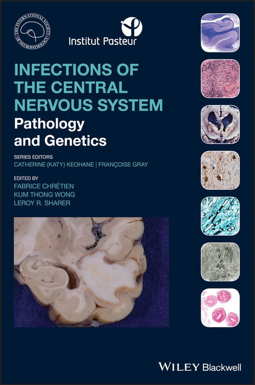 Infections of the Central Nervous System by Fabrice Chretien ISBN 9781119467762