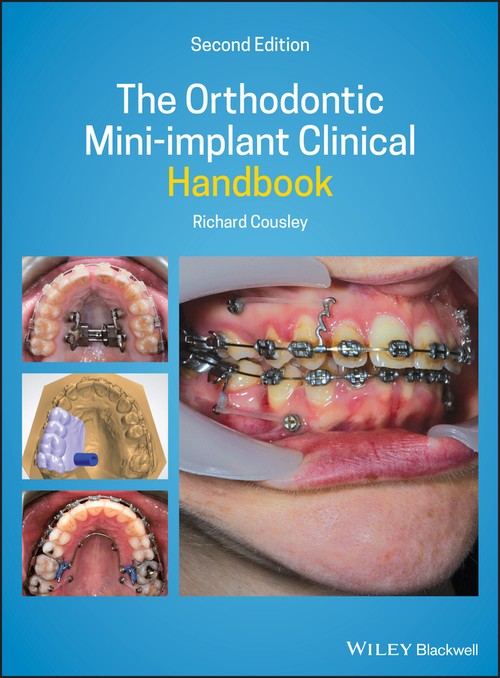 The Orthodontic Mini-implant Clinical Handbook by Richard Cousley ISBN 9781119509752