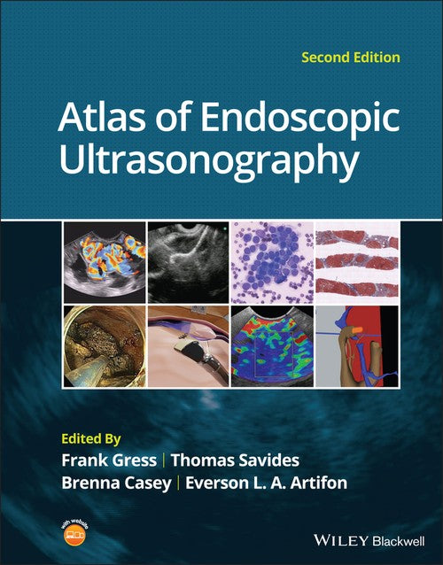 Atlas of Endoscopic Ultrasonography by Frank G Gress ISBN 9781119523000