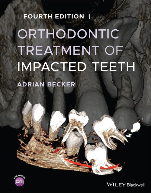 Orthodontic Treatment of Impacted Teeth by Adrian Becker ISBN 9781119565376