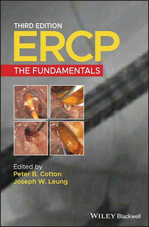 ERCP by Peter B Cotton ISBN 9781119601098