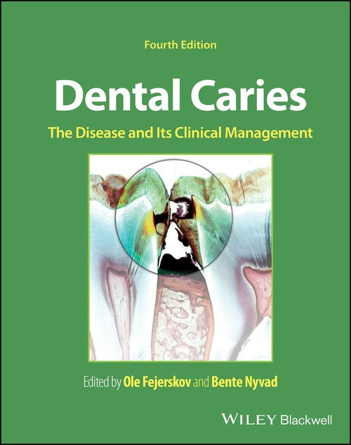 Dental Caries by Ole Fejerskov ISBN 9781119679370