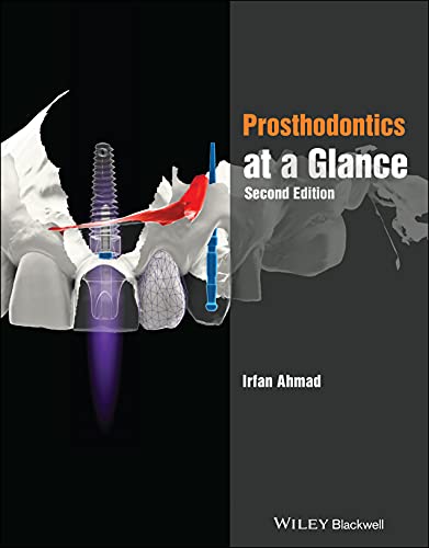 Prosthodontics at a Glance by Irfan Ahmad Bds ISBN 9781119749721