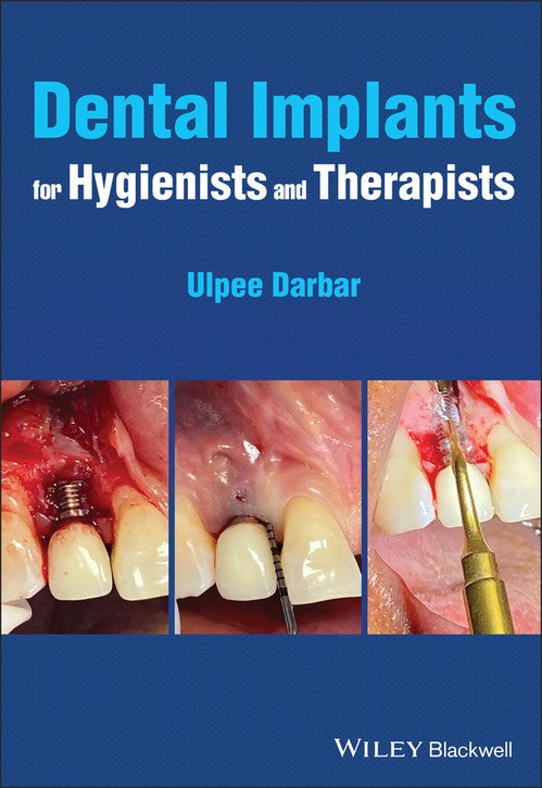 Dental Implants for Hygienists and Therapists by Ulpee R Darbar ISBN 9781119763826