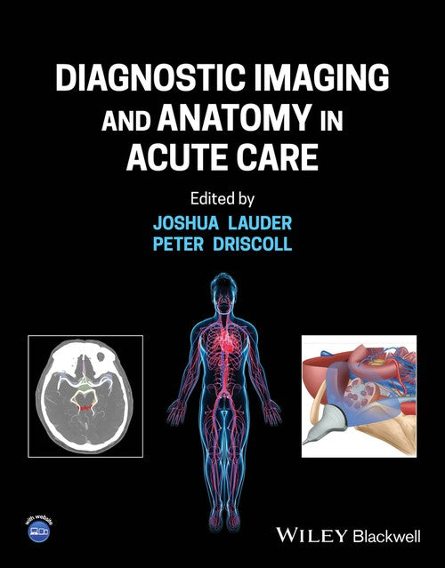 Diagnostic Imaging and Anatomy in Acute Care by Joshua Lauder ISBN 9781119809449