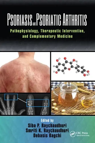 Psoriasis and Psoriatic Arthritis Pathophysiology, Therapeutic Intervention, and Complementary Medicine by Siba P. Raychaudhuri ISBN: 978-1032095868