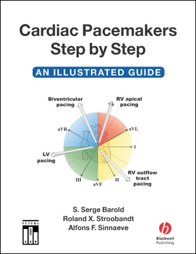 Cardiac Pacemakers Step by Step by S Serge Barold ISBN 9781405116473