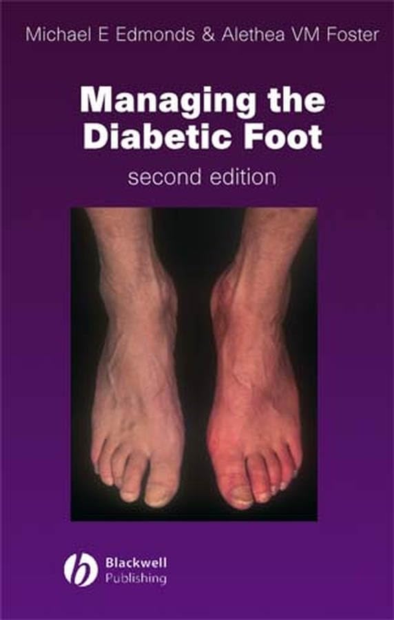 Managing the Diabetic Foot by Michael E Edmonds
