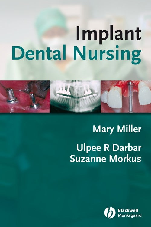 Implant Dental Nursing by Mary Miller Assessment Centre For Dental Nurses Eastman Dental Hospital London) ISBN 9781405144285