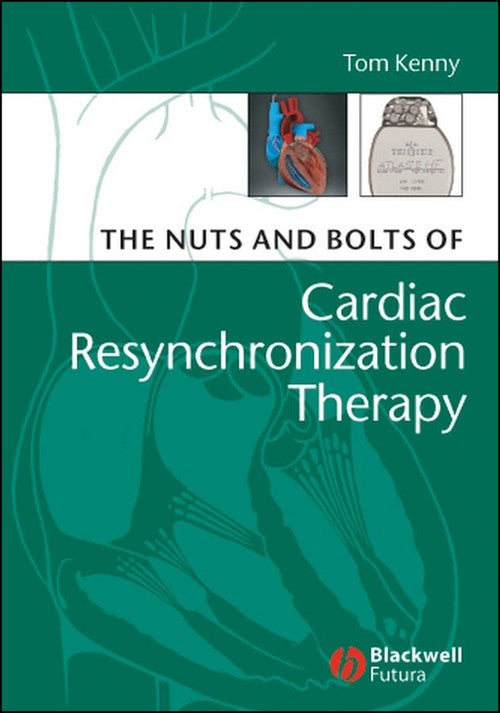 The Nuts and Bolts of Cardiac Resynchronization Therapy by Tom Kenny ISBN 9781405153720