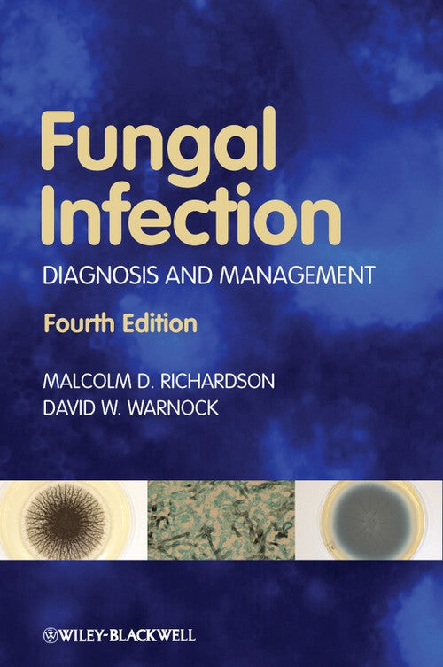Fungal Infection by Malcolm D Richardson ISBN 9781405170567