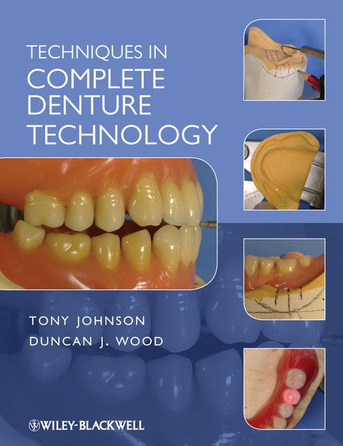 Techniques in Complete Denture Technology by Tony Johnson ISBN 9781405179096