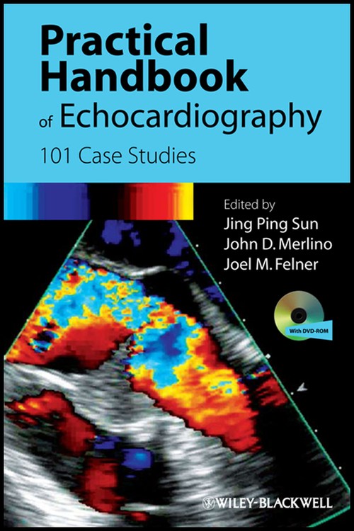 Practical Handbook of Echocardiography by Jing Ping Sun Emory University School Of Medicine ) ISBN 9781405195560