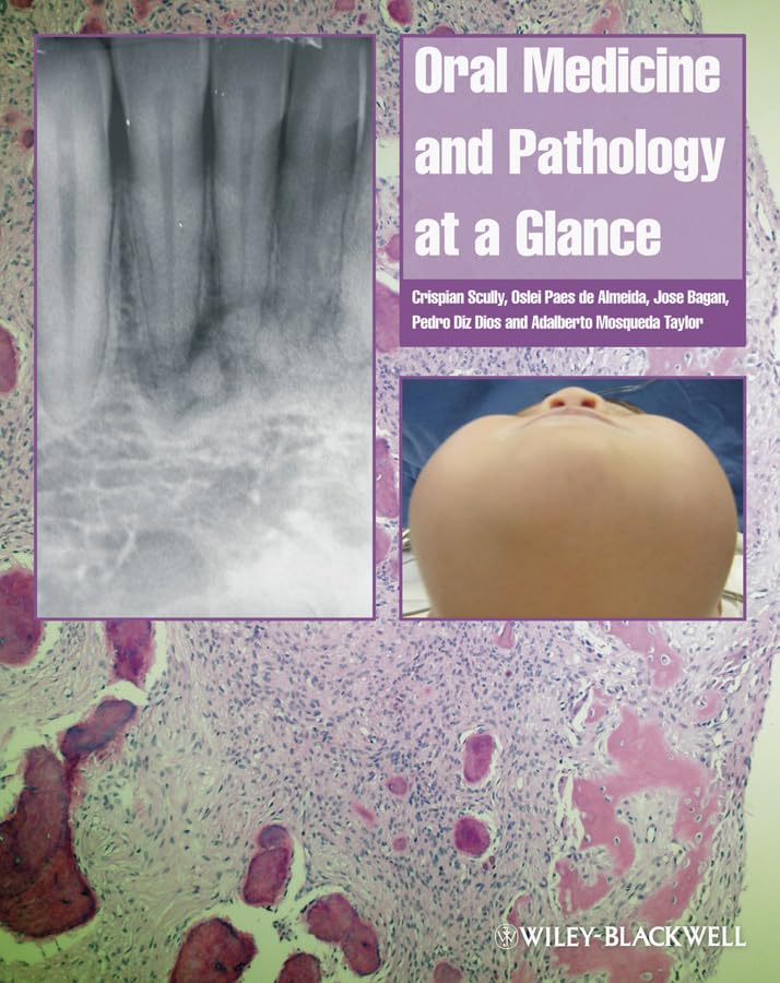 Oral Medicine and Pathology at a Glance by Crispian Scully Cbe ISBN 9781405199858