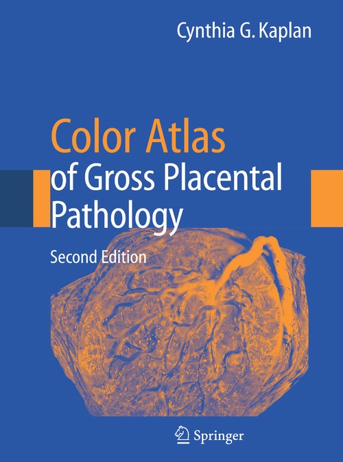 Color Atlas of Gross Placental Pathology by Cynthia G Kaplan ISBN 9781493950355