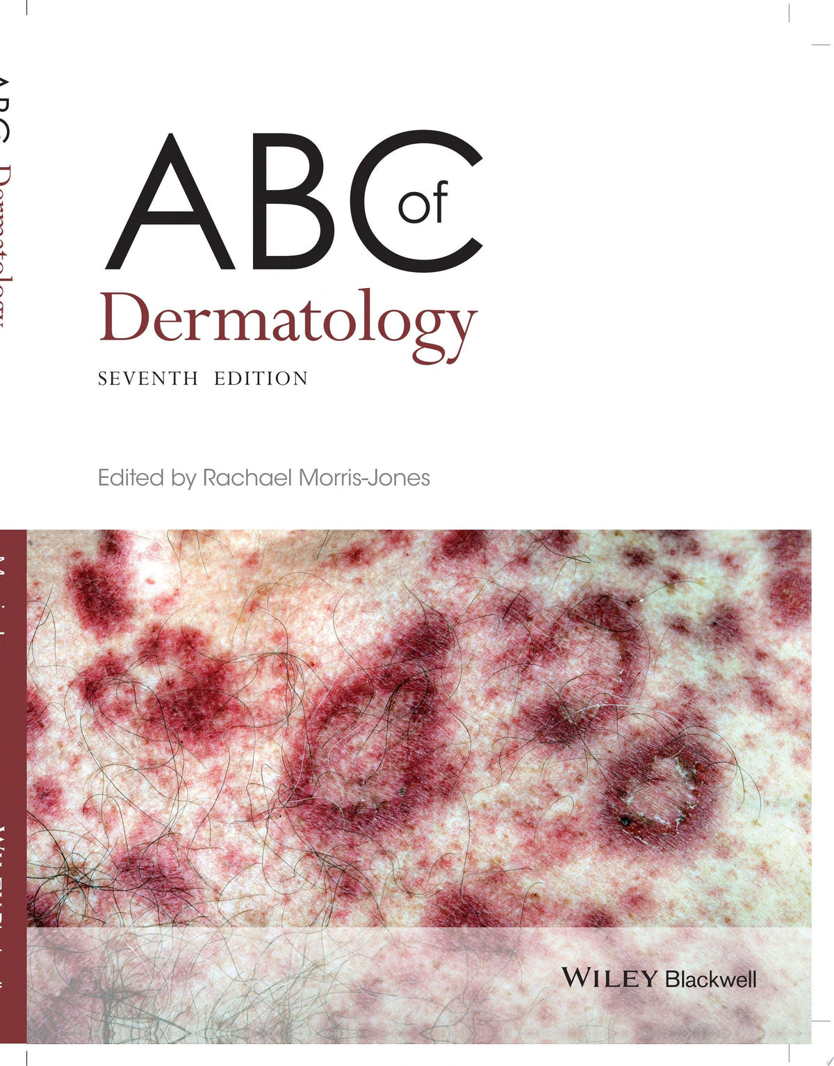 ABC of Dermatology 7th Edition - front cover