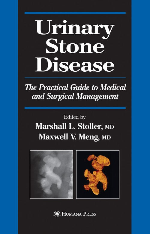 Urinary Stone Disease by Marshall L Stoller Md ISBN 9781588292193