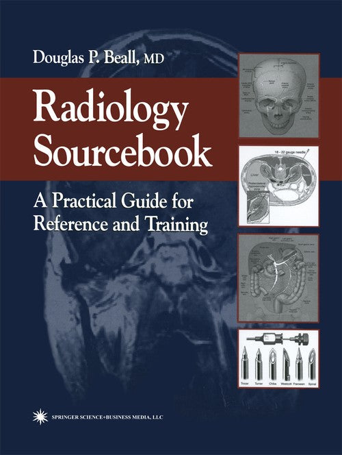 Radiology Sourcebook by Douglas P Beall 9781617373770