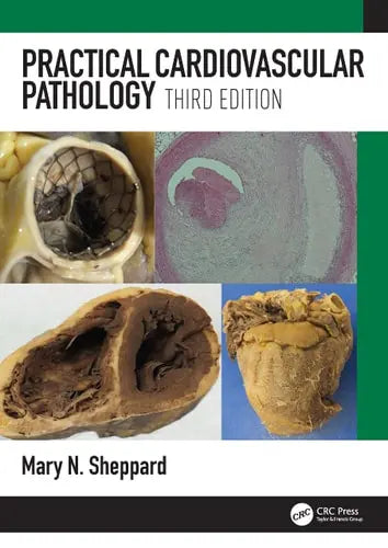 Practical Cardiovascular Pathology by Mary N. Sheppard ISBN: 978-1498787550
