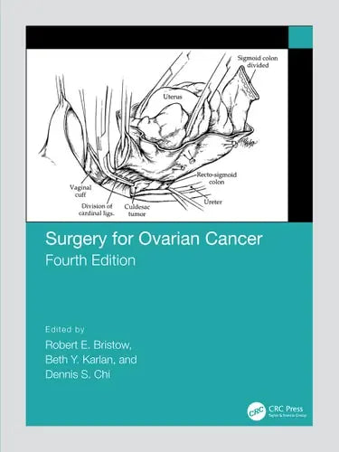 Surgery for Ovarian Cancer by Robert Bristow 4th Edition ISBN 9780367150044
