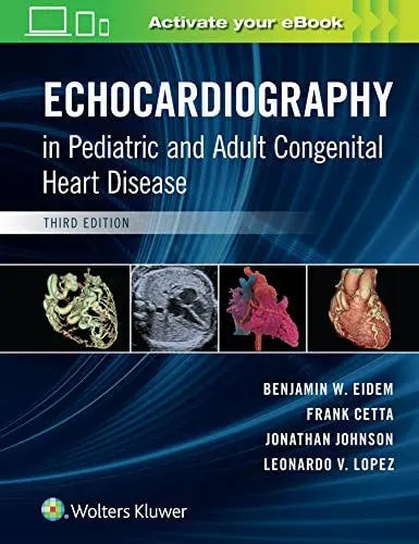 Echocardiography in Pediatric and Adult Congenital Heart Disease by Benjamin W. Eidem 3rd Edition ISBN 9781496394019
