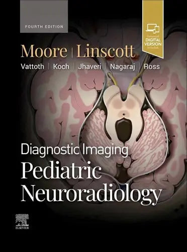 Diagnostic Imaging: Pediatric Neuroradiology by Kevin R. Moore,Luke L. Linscott 978-0443234927