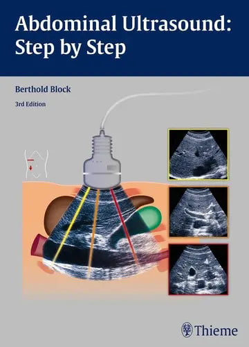 Abdominal Ultrasound Step by Step by Berthold Block ISBN: 978-3131383631 - front cover