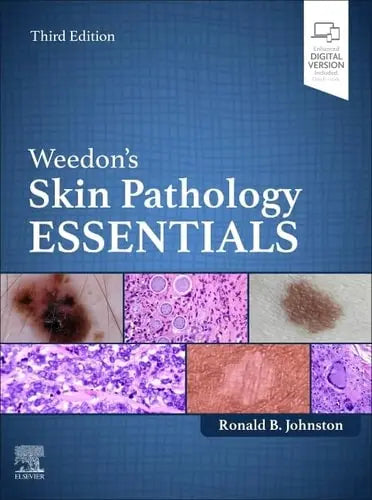 Weedon's Skin Pathology Essentials by Ronald Johnston 978-0702084478