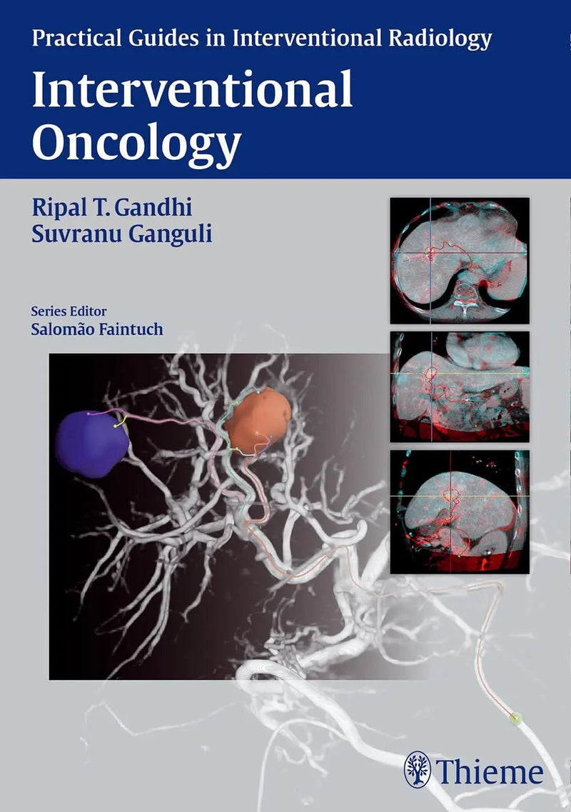 Interventional Oncology by Ripal T. Gandhi ISBN 9781626230811