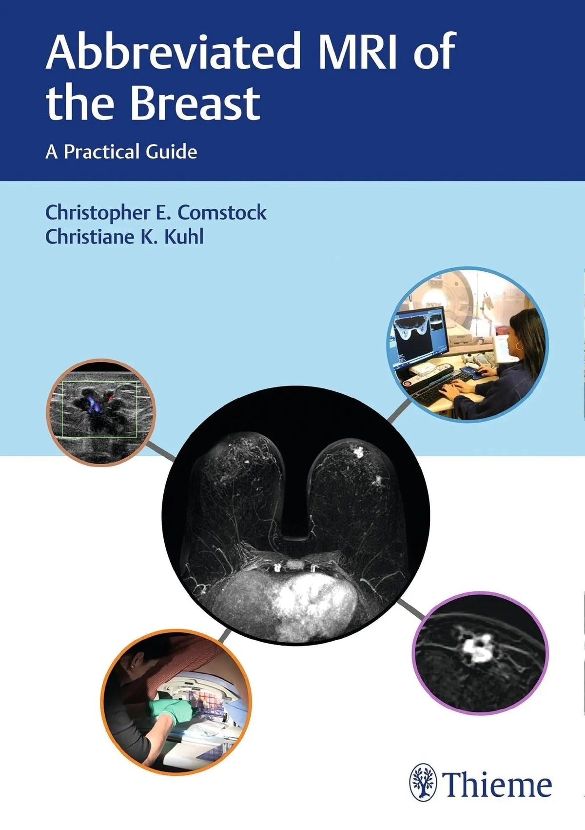 Abbreviated MRI of the Breast A Practical Guide by Christopher E. Comstock ISBN 9781626231931 - front cover