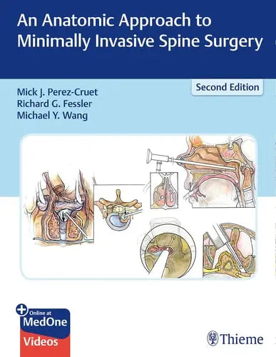 An Anatomic Approach to Minimally Invasive Spine Surgery by Mick J. Perez-Cruet ISBN: 978-1626236431 - front cover