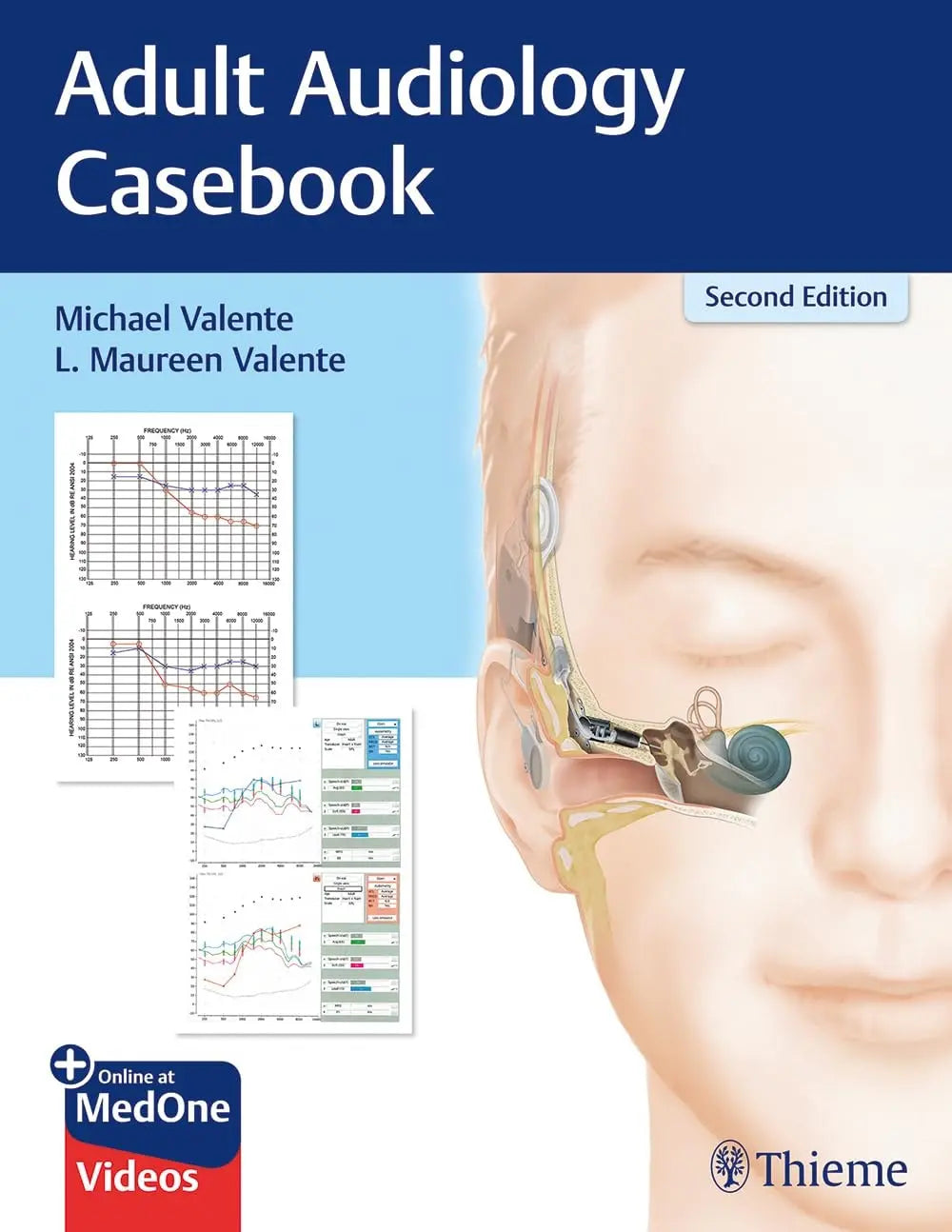 Adult Audiology Casebook by Michael Valente 2nd Edition ISBN 9781626237292 - front cover