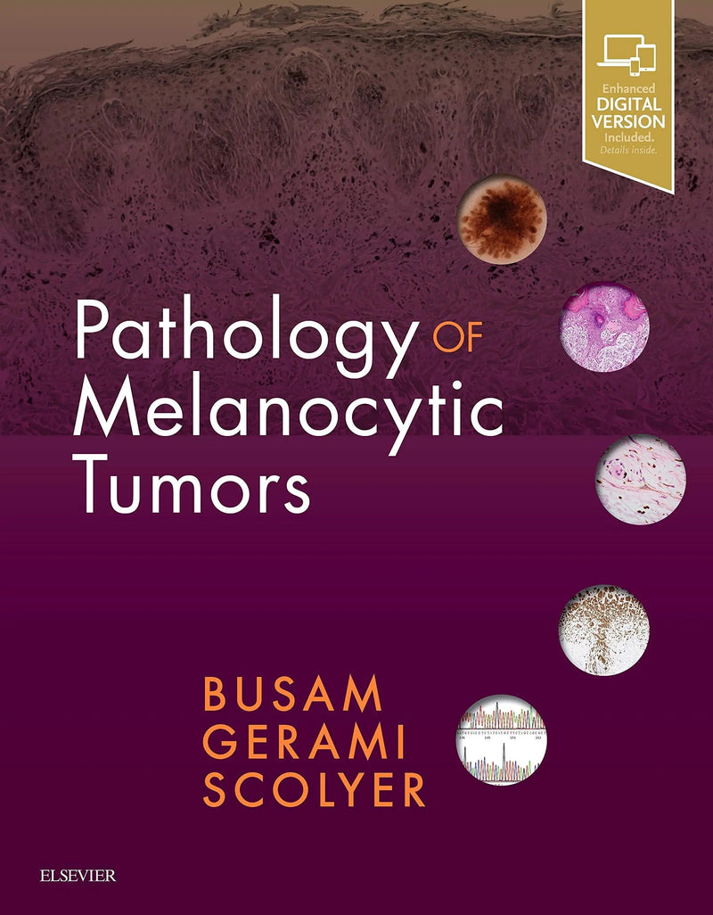 Pathology of Melanocytic Tumors by Klaus J. Busam 1st Edition