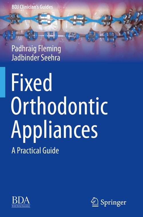 Fixed Orthodontic Appliances by Padhraig Fleming ISBN 9783030121679