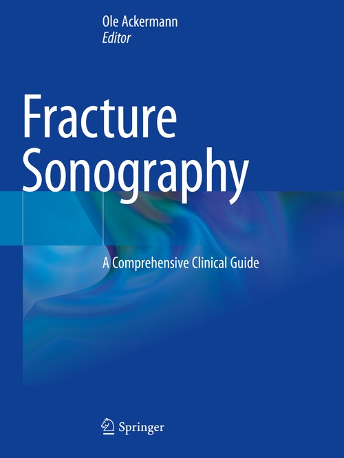 Fracture Sonography by Ole Ackermann ISBN 9783030638412