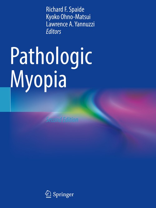 Pathologic Myopia by Richard F Spaide ISBN 9783030743369