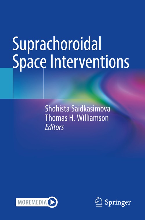 Suprachoroidal Space Interventions by Shohista Saidkasimova ISBN 9783030768553