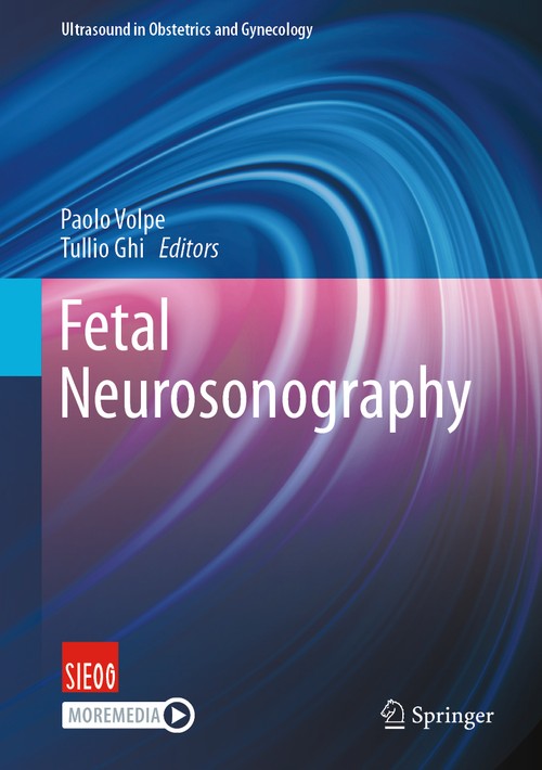 Fetal Neurosonography by Paolo Volpe ISBN 9783031701917