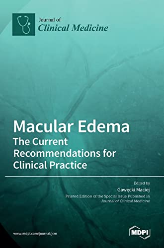 Macular Edema by Gawecki Maciej ISBN 9783036532578