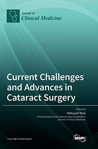 Current Challenges and Advances in Cataract Surgery by Nobuyuki Shoji ISBN 9783036562773