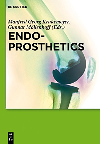 Endoprosthetics by Manfred Georg Krukemeyer ISBN 9783110305104