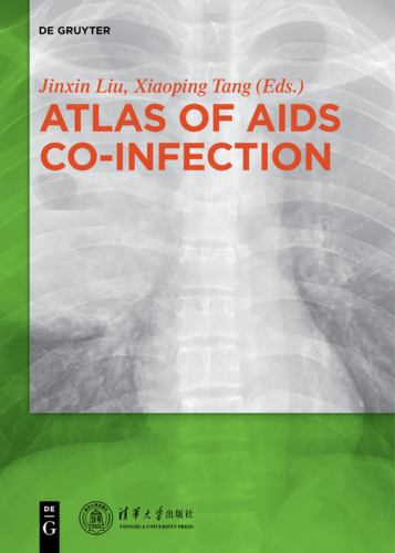 Atlas of AIDS Co-infection by Liu Jinxin ISBN 9783110353921