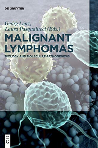 Malignant Lymphomas by Steven P Treon ISBN 9783110371192