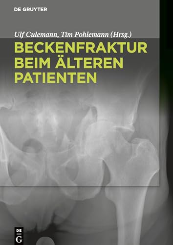 Beckenfraktur beim alteren Patienten by Ulf Culemann ISBN 9783110426489