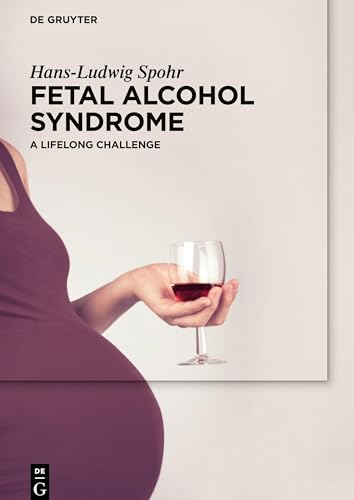 Fetal Alcohol Syndrome by Hans-Ludwig Spohr ISBN 9783110442076